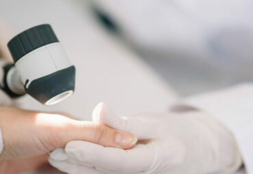 Closeup of dermatologist examining mole on hand of female patient in clinic